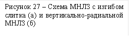 Рисунок 27 – Схема МНЛЗ с изгибом слитка (а) и вертикально-радиальной МНЛЗ (б)