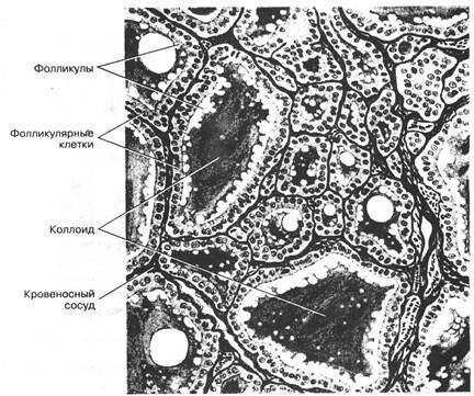 +Щитовидная железа (гистоструктура)
