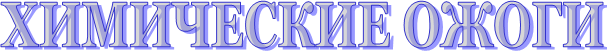 ХИМИЧЕСКИЕ ОЖОГИ