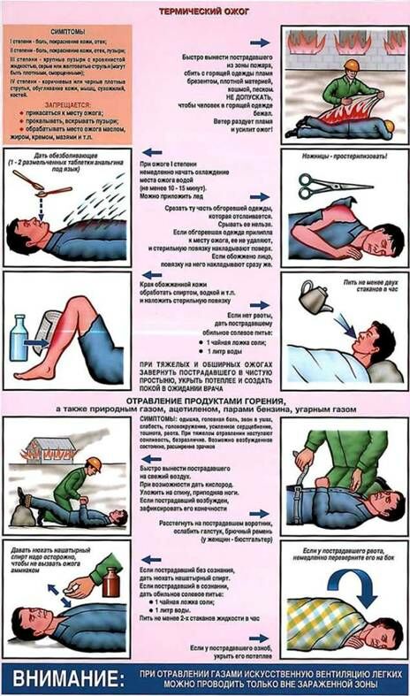 Техника реанимации