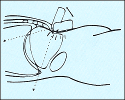 Схема движения датчика при УЗИ печени.