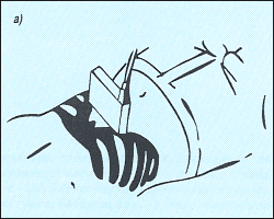 Схема наложения датчика для получения поперечного среза печени.