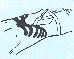 Продольное сканирование печени - плотный контакт с кожей.