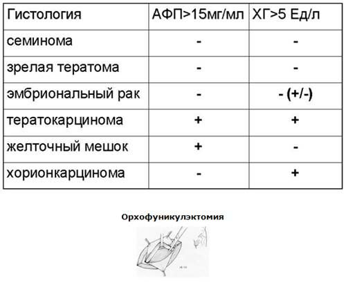 Описание: Простатит. Заболевания половых органов